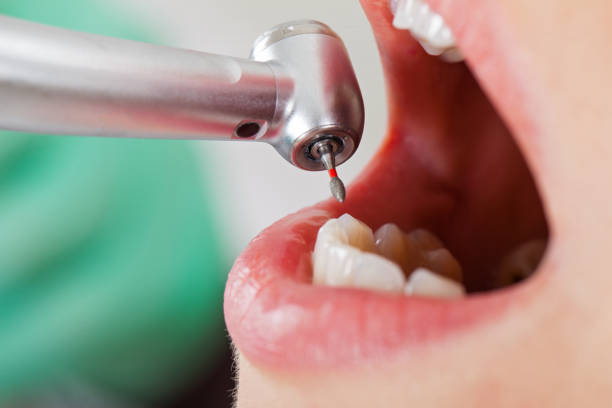 Best Pediatric Emergency Dentist in St Marys, PA